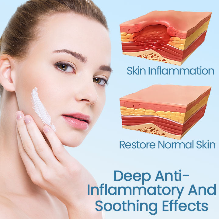 Ceoerty™ Skin Soothing Redness Relief Cream