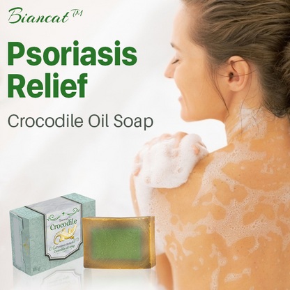 Biancat™ Psoriasis Relief Crocodile Oil Soap